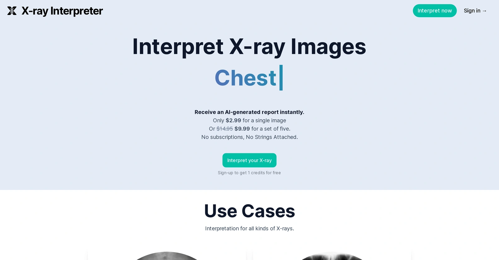 X-ray-Interpreter